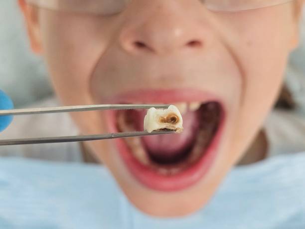 Best Emergency Gum Treatment in Troy, NC
